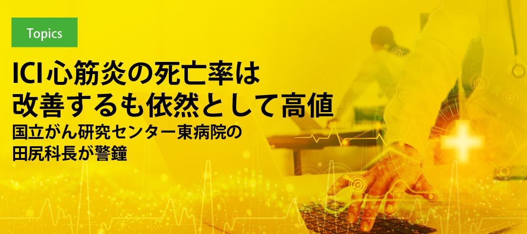 ICI心筋炎の死亡率は改善するも依然として高値