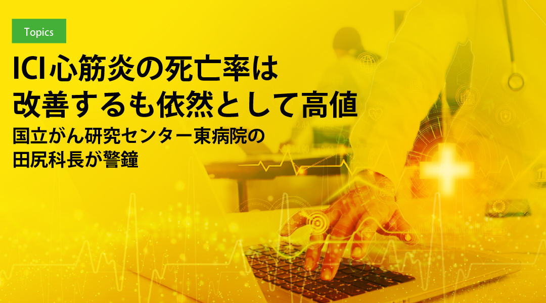 ICI心筋炎の死亡率は改善するも依然として高値　国立がん研究センター東病院の田尻科長が警鐘